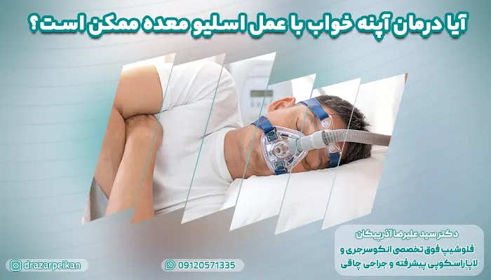 آیا درمان آپنه خواب با عمل اسلیو معده ممکن است؟