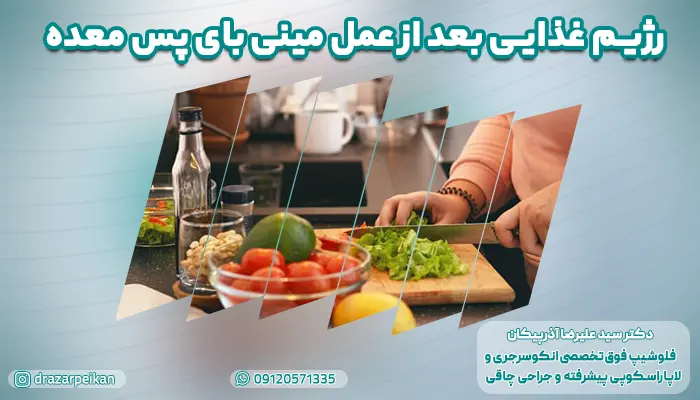 رژیم غذایی بعد از عمل مینی بای پس معده