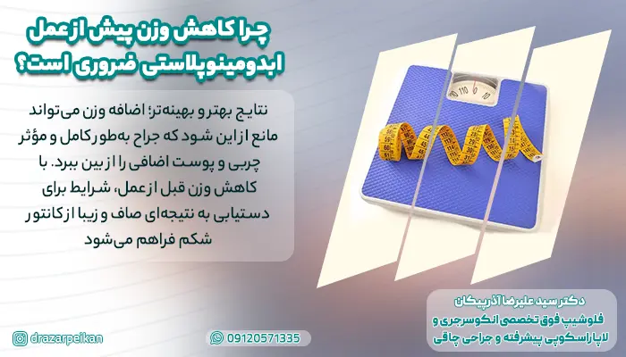 اهمیت کاهش وزن قبل از ابدومینوپلاست