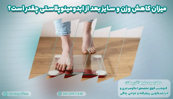میزان کاهش وزن و سایز بعد از ابدومینوپلاستی