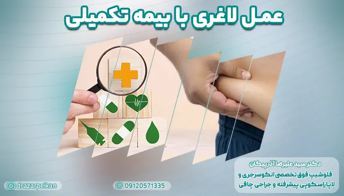 عمل لاغری با بیمه تکمیلی