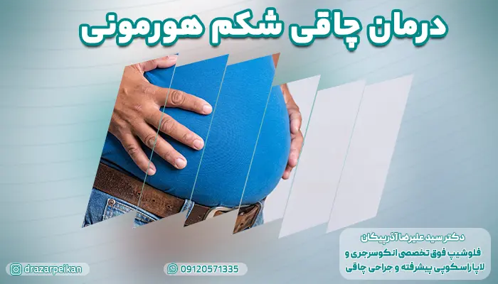 چاقی شکم هورمونی