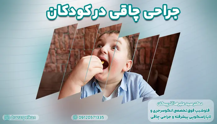 تصویر یک کودک چاق