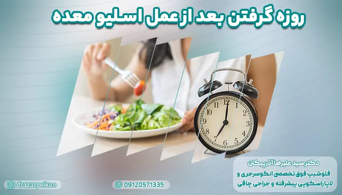 روزه گرفتن بعد از عمل اسلیو معده