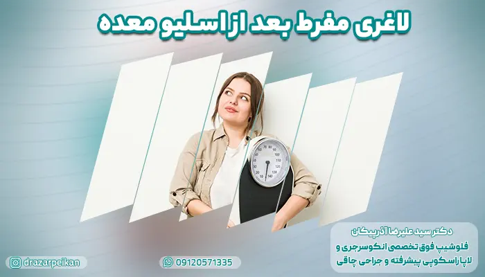 لاغری مفرط بعد از اسلیو معده