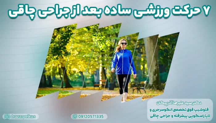 ورزش بعد از جراحی چاقی