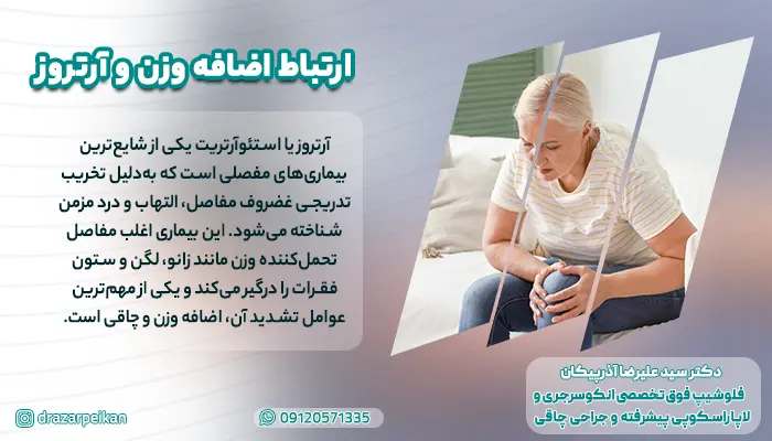 ارتباط اضافه وزن و آرتروز