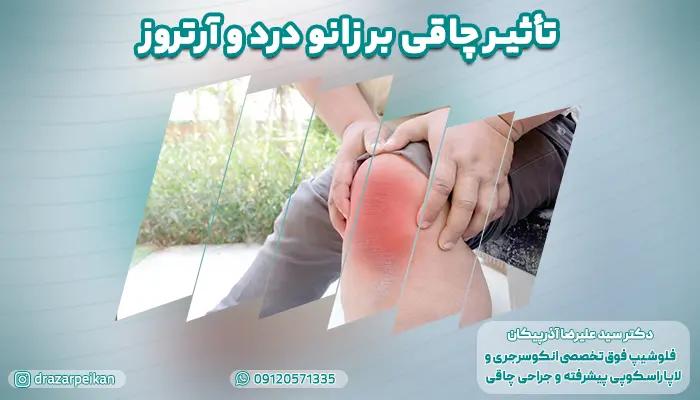 تاثیر چاقی بر زانو درد و آرتروز