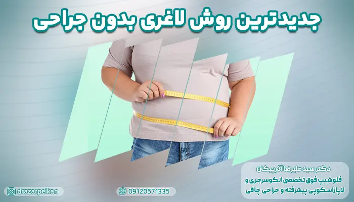 جدیدترین روش لاغری بدون جراحی