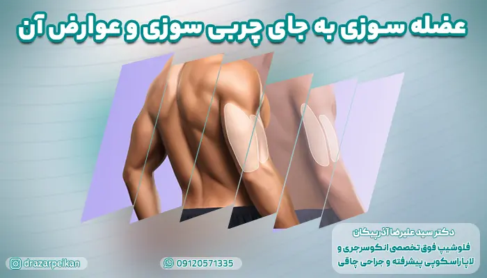 بررسی عضله سوزی به جای چربی سوزی و عوارض آن