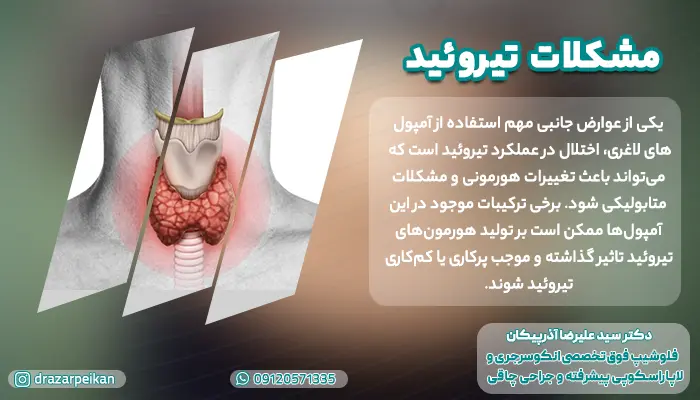 مشکلات تیروئید