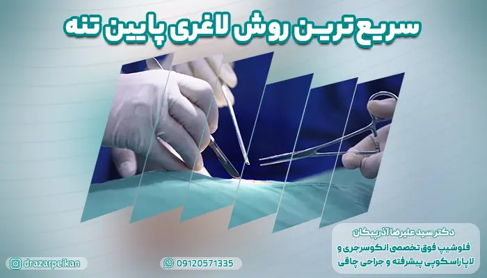 معرفی سریع ترین روش لاغری پایین تنه