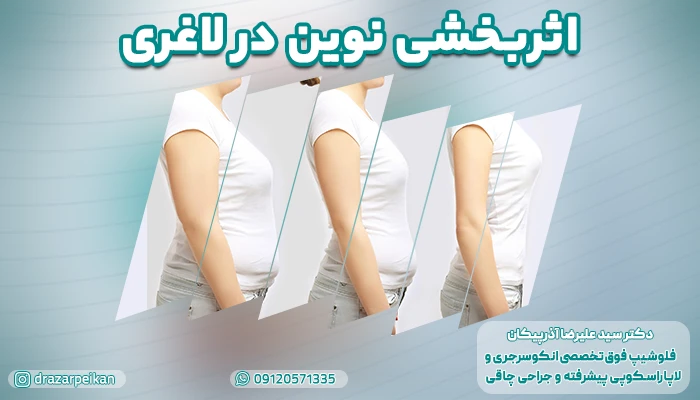 اثربخشی نوین در لاغری؛ مقایسه جراحی اسلیو به تنهایی و ترکیب آن با داروهای کمککننده