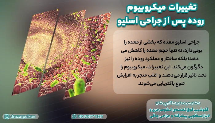تغییرات میکروبیوم روده پس از جراحی اسلیو | ربط چاقی و میکروبیوم روده