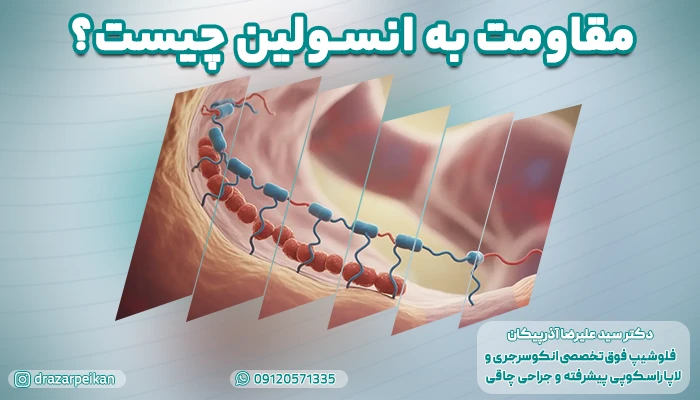 مقاومت به انسولین چیست؟ دلایل، راههای درمان و علائم مقاومت به انسولین