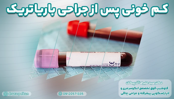 کم خونی پس از جراحی باریاتریک؛ تشخیص و درمان تخصصی