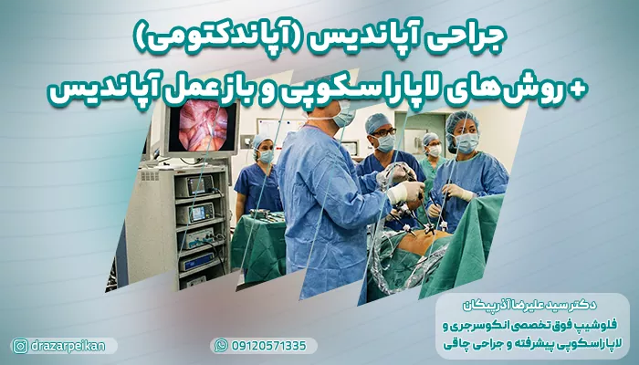 جراحی آپاندیس (آپاندکتومی) + روش‌های لاپاراسکوپی و باز عمل آپاندیس