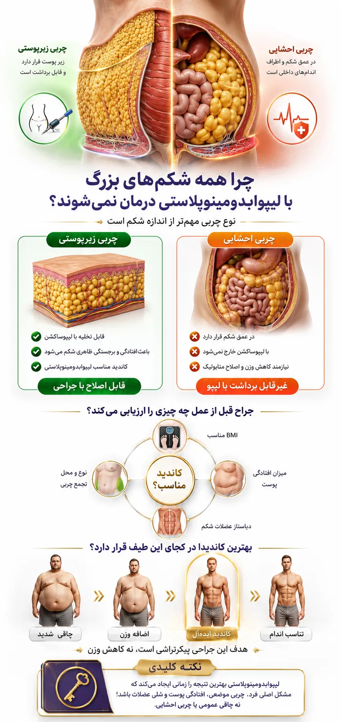 اینفوگرافیک چرا همه شکم های بزرگ با لیپوابدومینوپلاستی درمان نمیشوند؟