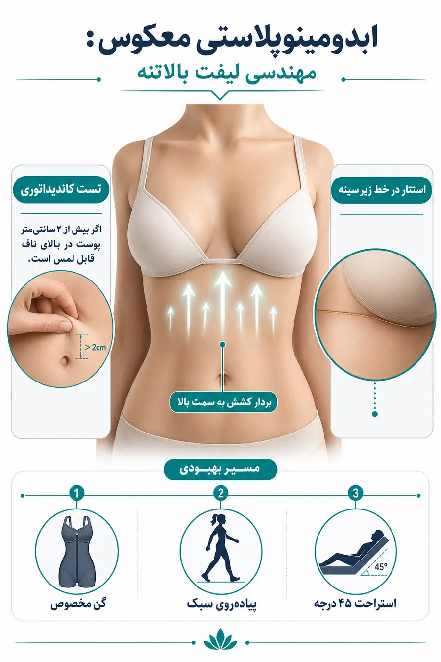 اینفوگرافی ابدومینوپلاستی معکوس