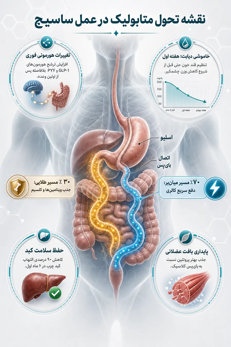 اینفوگرافیک ساسیج معده | عمل ساسج بای پس معده: روش مدرن کاهش وزن